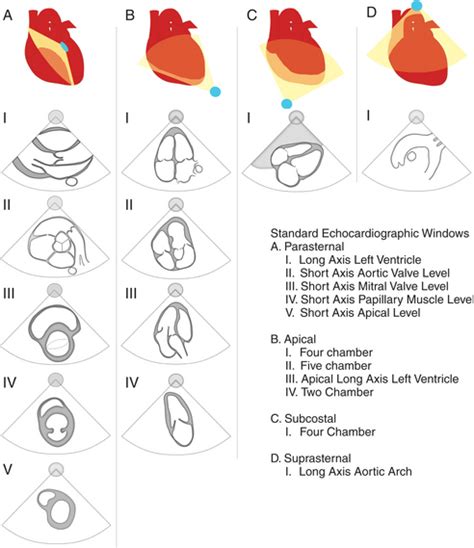 Echocardiography | Radiology Key