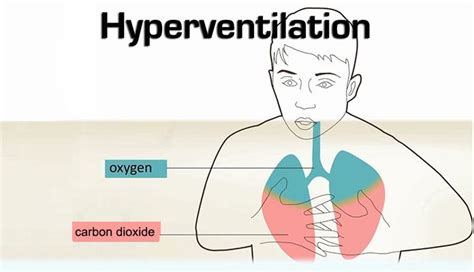 Hypoxia and Hypoxemia – Symptoms, Causes, & Treatments – Page 9 – New Life Ticket