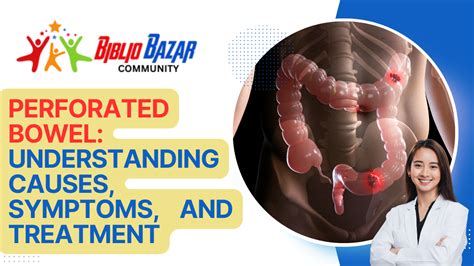 Understanding Perforated Bowel: Causes, Symptoms, Treatment, and Care - Bibliobazar Digi Books