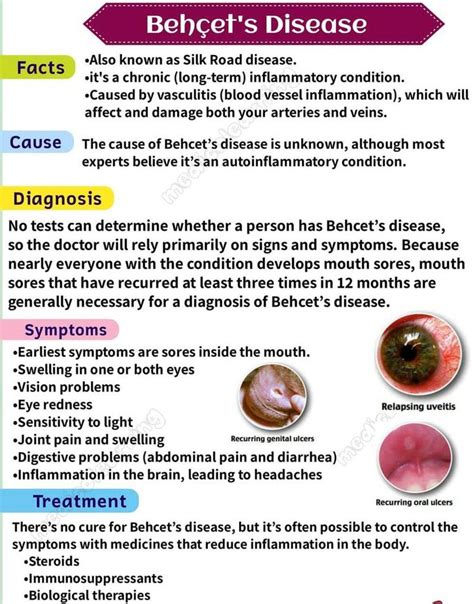 Behcet's Disease - MEDizzy