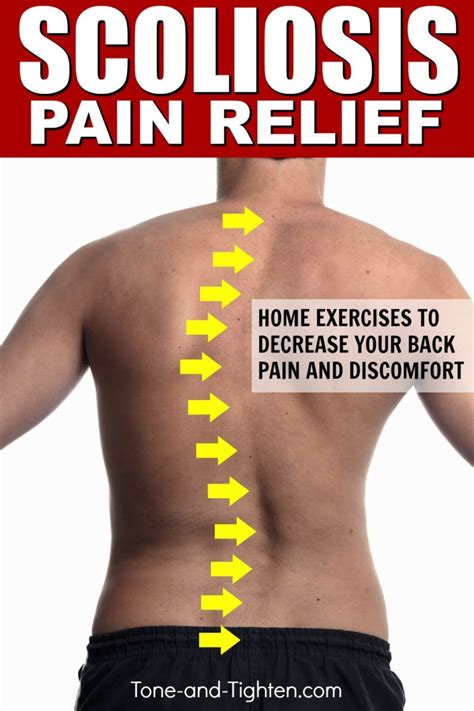 How To Treat Scoliosis – Best Exercises | #site_title