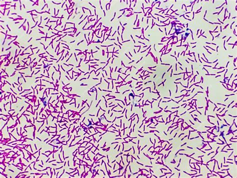 Gram Stain E Coli