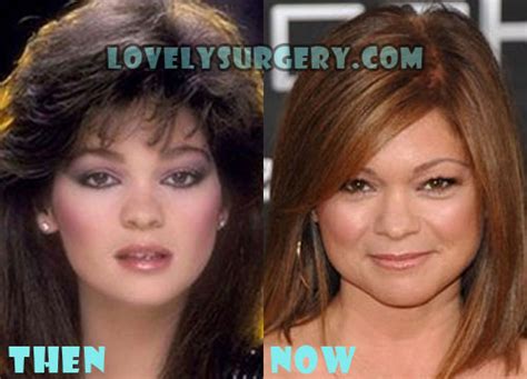 Valerie Bertinelli Plastic Surgery Before and After Rumor - Lovely Surgery