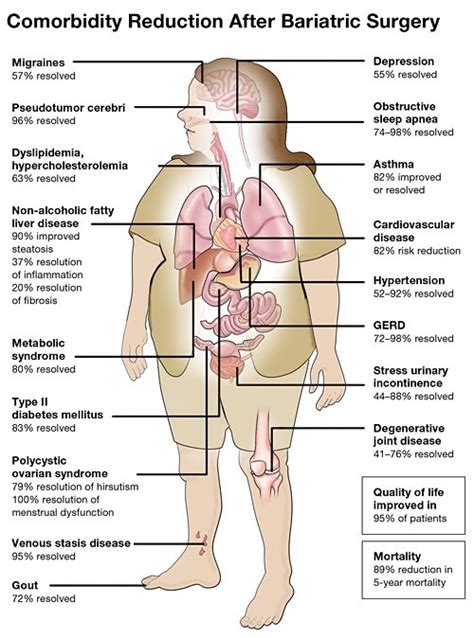 Health Risks Associated with Obesity | Panhandle Weight Loss Center in Amarillo TX