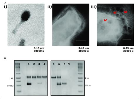 | T4 phage attachment to EcN cells: (A) Transmission electron... | Download Scientific Diagram