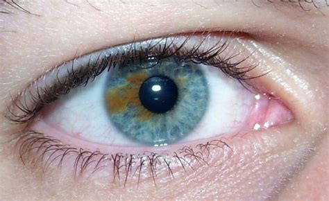 Musings of a Biologist and Dog Lover: Heterochromia: Types and Causes