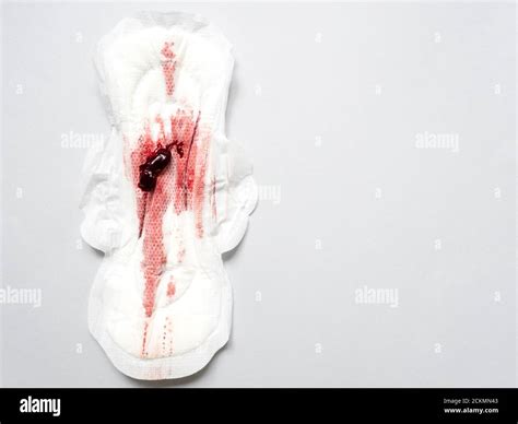 Endometriosis High Resolution Stock Photography and Images - Alamy