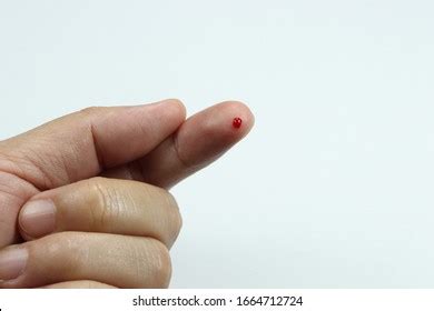 Bleeding Images, Stock Photos & Vectors | Shutterstock