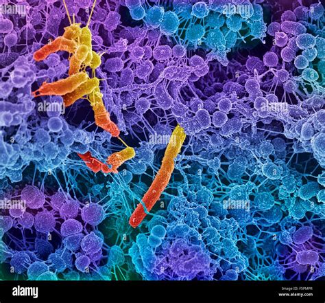 Oral bacteria. Coloured scanning electron micrograph (SEM) of mixed oral bacteria (Streptococcus ...