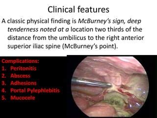 L acute appendicitis | PPT