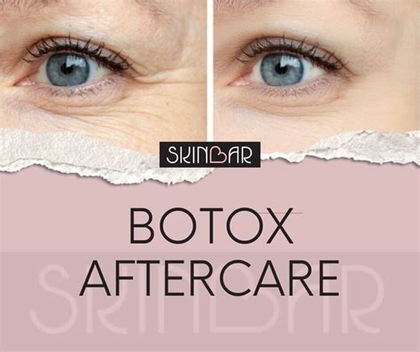 Botox Post Aftercare Treatment Instructions - Skin Bar Med Spa