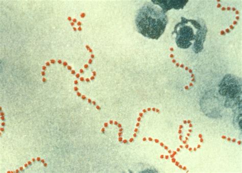 Streptococcus Lactis Gram Stain