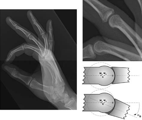 Human knuckles behavior. | Download Scientific Diagram