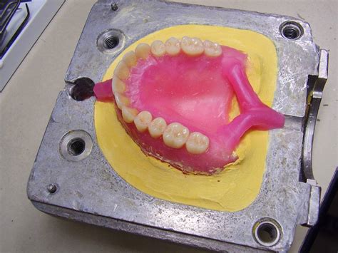 What are the steps to make complete dentures? – Dentsma.com