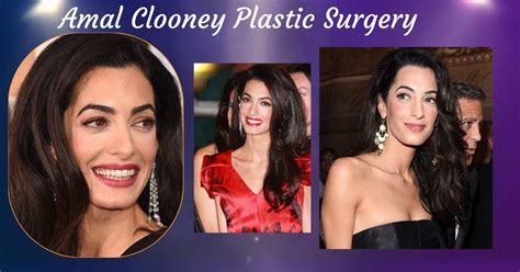 Amal Clooney Plastic Surgery: Has She Had Botox, a Facelift, and Eyelid Surgery? - Lake County News