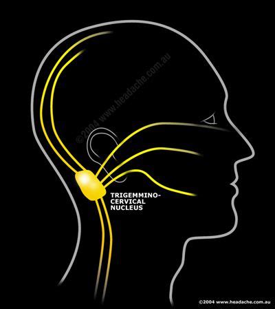 Neuralgias: Nerve Pain