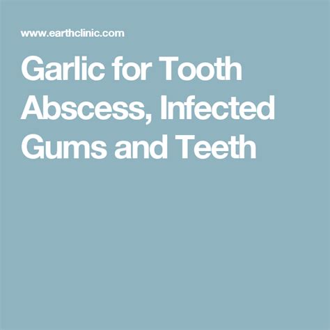 Garlic for Tooth Abscess, Infected Gums and Teeth | Natural cures, Tooth infection, The cure