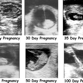 Ultrasound images of embryo or fetal development at various stages of... | Download Scientific ...