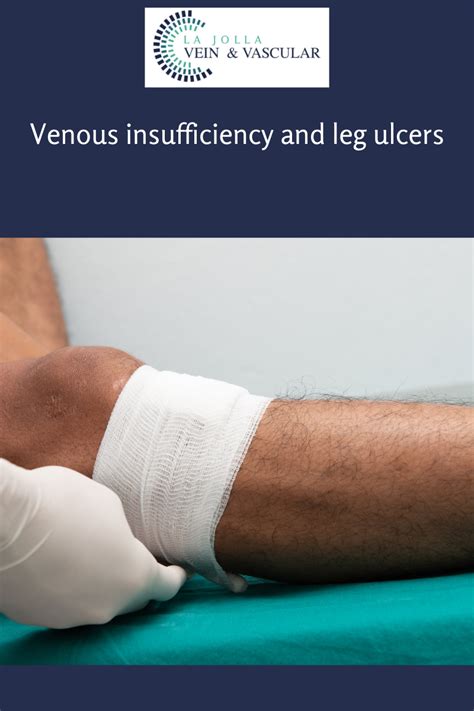 Vein & Vascular Treatment