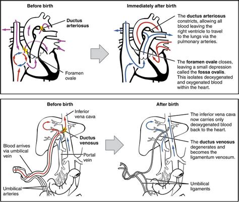 fetal circulation changes at birth - Google Search | Med | Pinterest ...