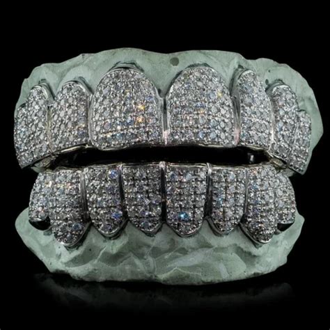 Real Diamonds Round Diamond Teeth Grillz, Weight: Custom at Rs 49999/piece in Surat