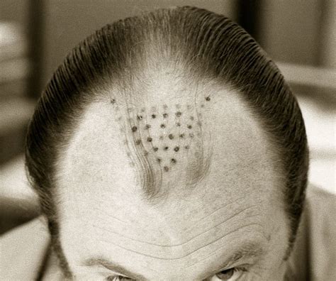 Flickriver: Most interesting photos tagged with hairplugs