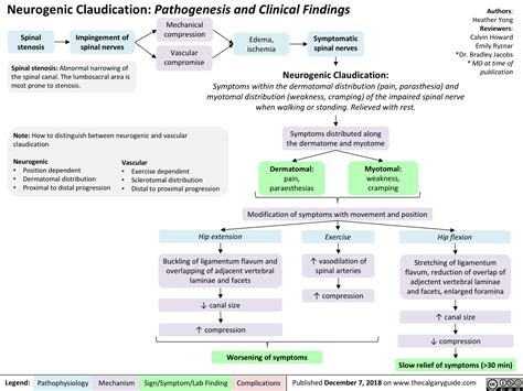 Neurogenic Claudication: Pathogenesis and Clinical Findings | Calgary Guide