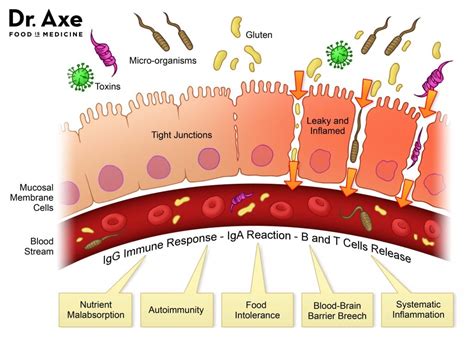 What Is Leaky Gut Syndrome And How Do You Fix It? | Examined Existence