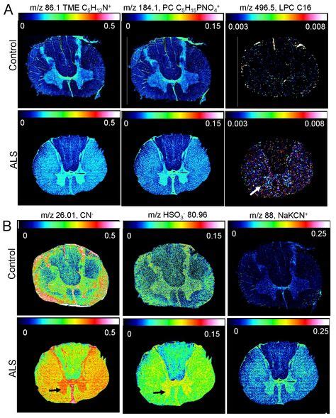 49 Best Mass spectrometry imaging ideas | mass spectrometry, mass, image