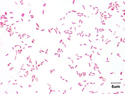 BIOL 230 Lab Manual: Gram Stain of Pseudomonas aeruginosa