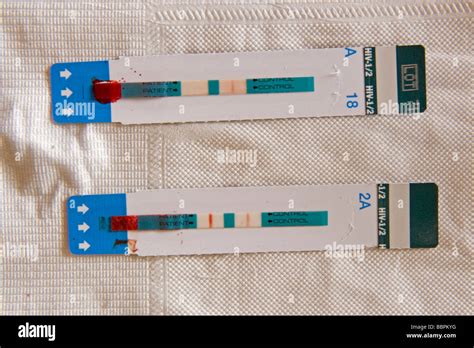 Rapid HIV test - a visual line at both the test and control sites indicates a positive test ...