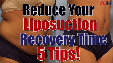 Liposuction Recovery Care - Reduce Your Liposuction Surgery Recovery ...