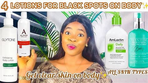 4 BEST BODY LOTION FOR DARK SPOTS ON BODY |How To Get Clear Skin + *Cream For Black Spots ...