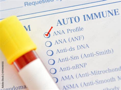 Blood sample for antinuclear antibody or ANA test Stock Photo | Adobe Stock