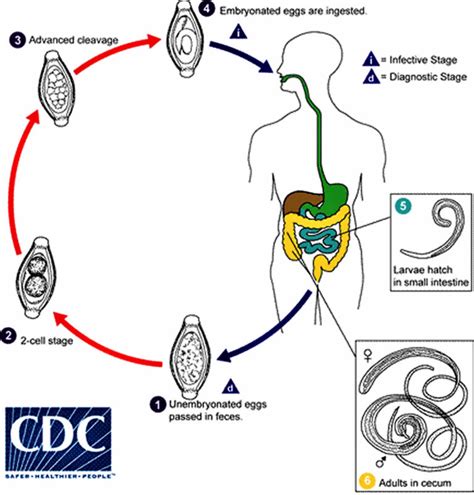 Trichuris trichiura infection, transmission, lifee cycle, symptoms, diagnosis & treatment