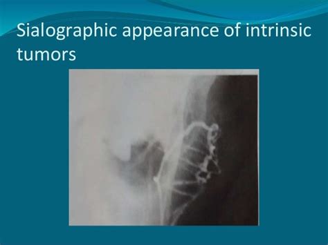 Salivary gland imaging