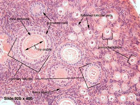 This image shows the histology of ovarian follicles. Examples of primordial and primary ...