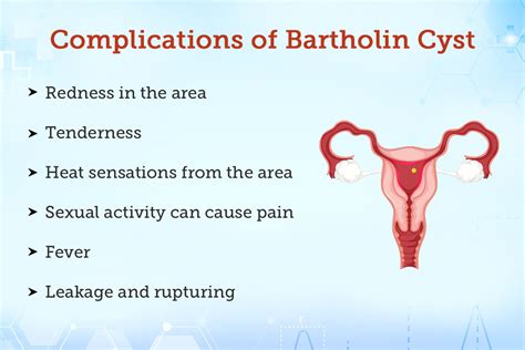 Bartholin Cyst: Causes And At-Home Or Medical Treatment, 57% OFF