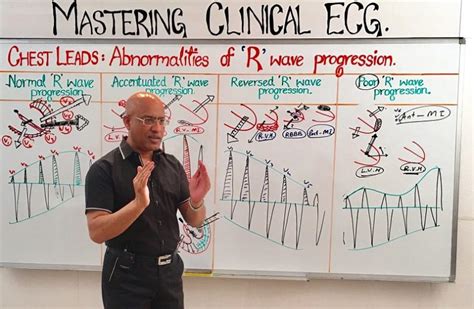 Chest Leads – Abnormalities of R wave progression » Dr. Najeeb Lectures