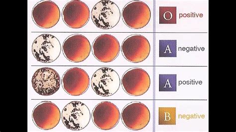 Understanding Blood Type Results | Review and Practice - YouTube