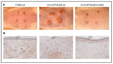 Viruses | Special Issue : Expert Views on HPV Infection