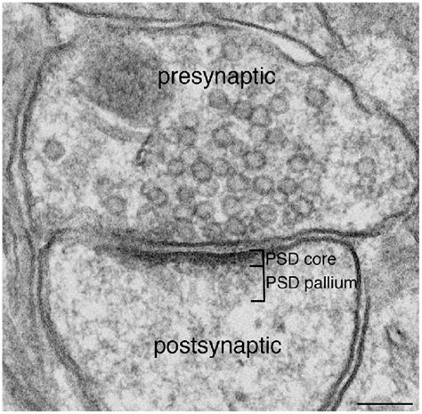 Frontiers | The Postsynaptic Density: There Is More than Meets the Eye
