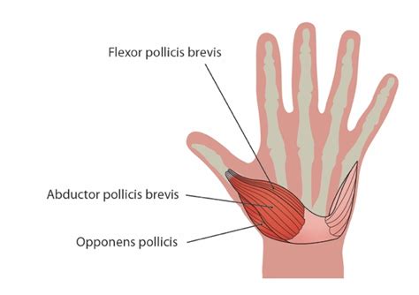 Flexor Pollicis Brevis