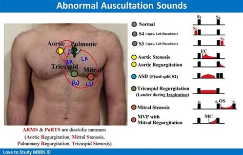 Abnormal Auscultation Sounds in 2021 | Aortic stenosis, Med school ...