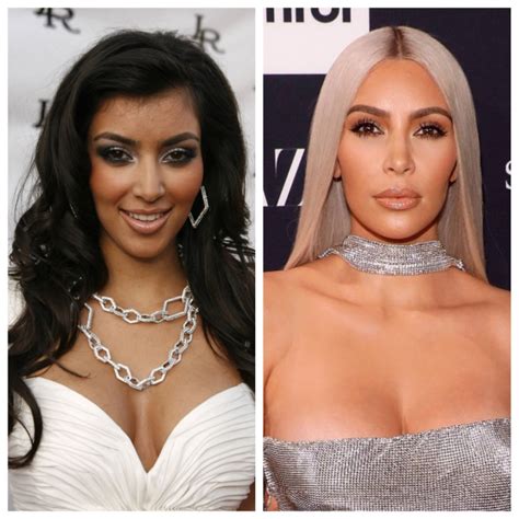 Kim Kardashian Before And After: Plastic Surgery Timeline