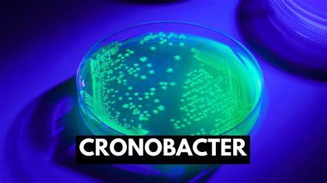 Cronobacter, Causes, Signs and Symptoms, Diagnosis and Treatment. - YouTube