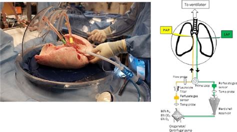 Ex vivo lung perfusion circuit with schematic representation; note the ...