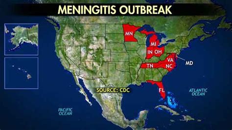 CDC: 91 cases of rare fungal meningitis surface | Fox News Video