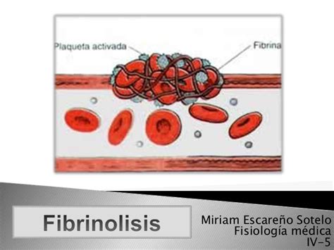 Fibrinolisis