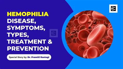 Hemophilia: Disease, Symptoms, Types, Treatment And Prevention - EBNW Story